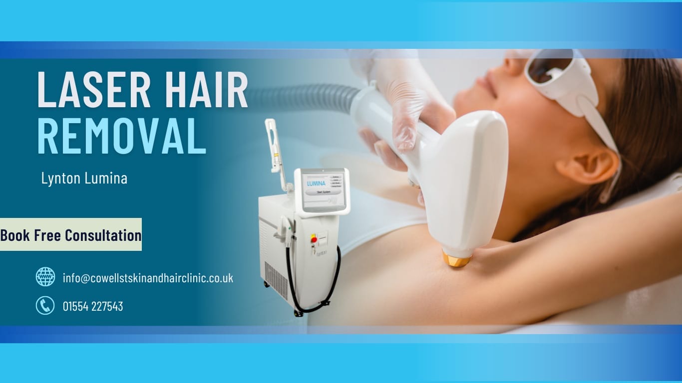 Laser hair removal